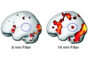 How clear is our view of brain activity?