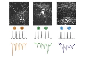 Clever Suppression in the Brain