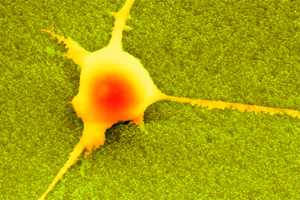 Nano Ruffles in Brain Matter