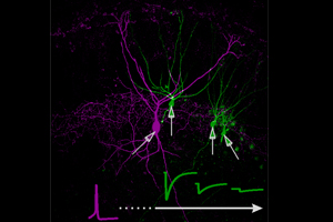 No More Neuronal Gibberish