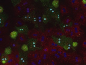 Drugs that Prevent Liver Failure 