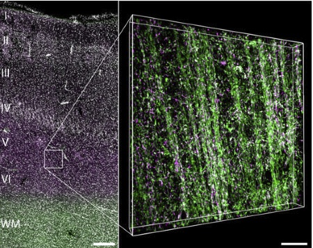 Epilepsy at the Molecular Level 