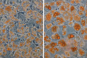 When fat cells change their colour