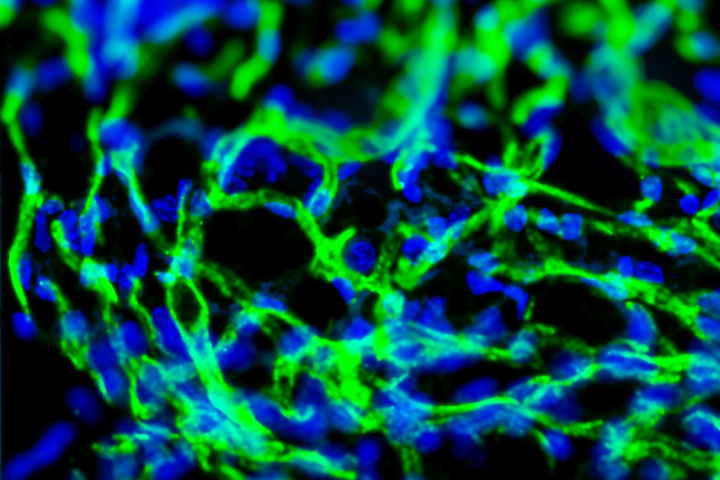 Creating blood vessels on demand 