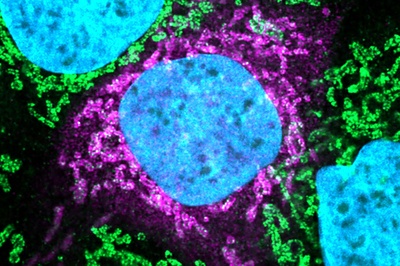 Common Vulnerabilities of Coronaviruses