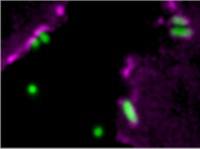 Cytoskeleton acts as cells' bouncer for bacteria