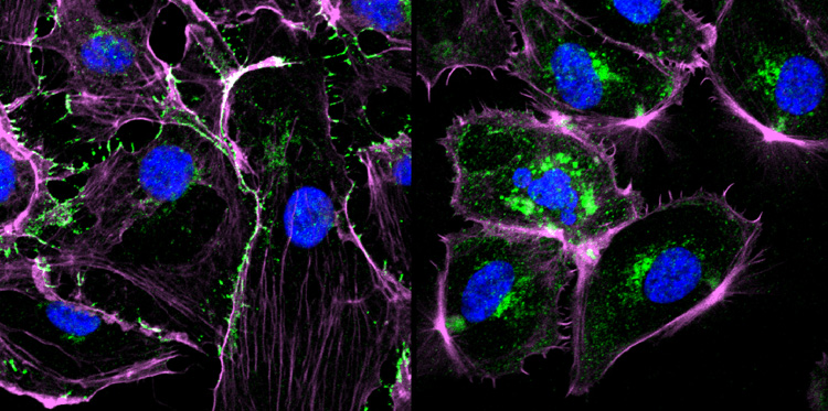 Pseudomonas aeruginosa Bacteria produce a molecule that paralyzes immune system cells