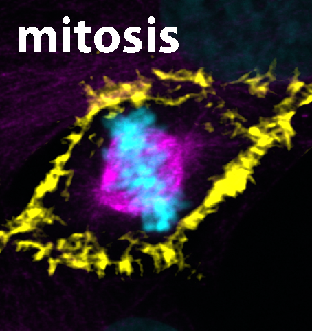 Eine fixierte menschliche Zelle während der Mitose. Die DNA ist blau eingefärbt, die Mikrotubuli sind violett und das Aktin ist gelb