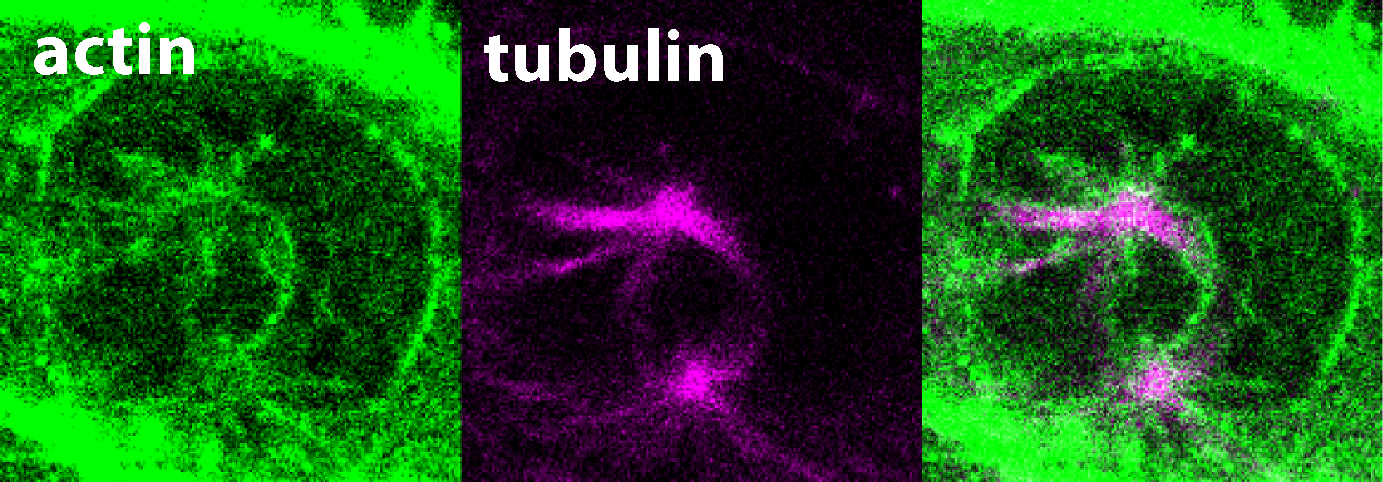 Ausschnitt einer Filmaufnahme von lebenden Zellen im Frühstadium der Mitose, grün eingefärbt ist das Aktin, violett eingefärbt sind die Mikrotubuli