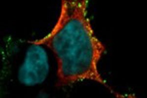 Selbstverdauung als Überlebensmechanismus