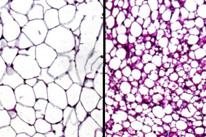 Epigenetisches Enzym steuert Fettbildung