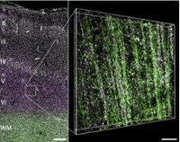 Epilepsie auf molekularer Ebene 