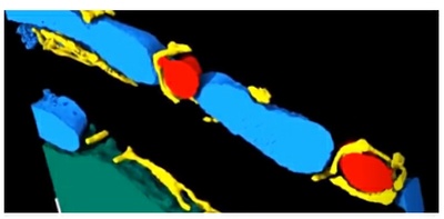 Einblicke in die dynamische Ultrastruktur des Herzens