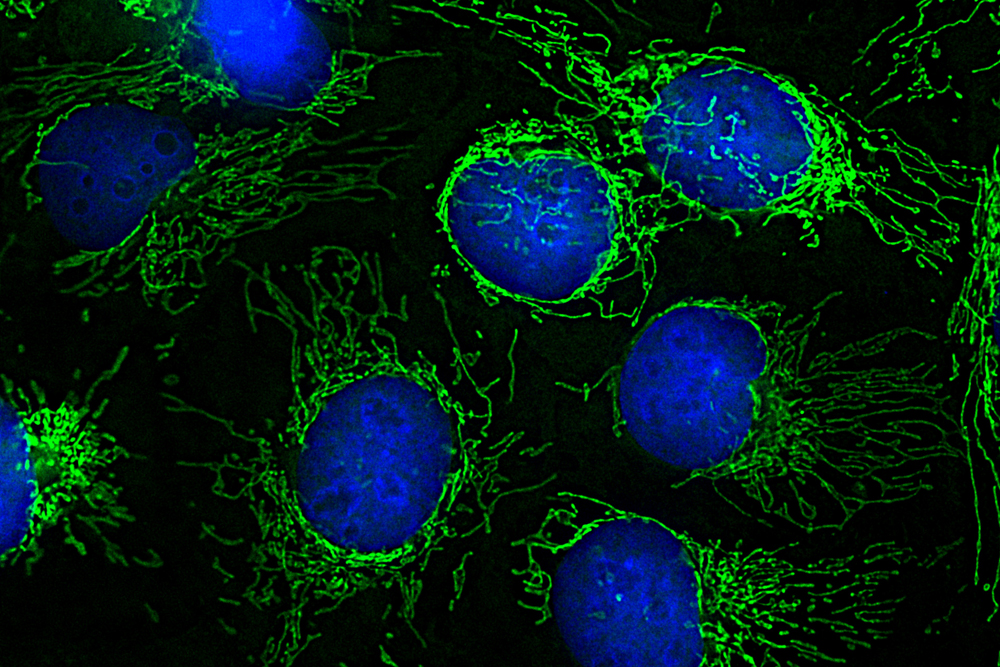 Eiweißmoleküle in Mitochondrien erstmals klar zugeordnet