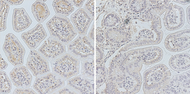 Körpereigenes Molekül schützt vor lebensbedrohlichen Komplikationen nach Stammzelltransplantation