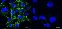 Zuckerbasierte Inhibitoren entwaffnen den Krankheitserreger Pseudomonas aeruginosa